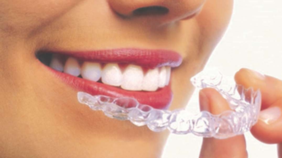 Mancia Orthodontics : Invisalign in Miami, FL | 33144